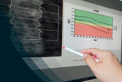 Densitometría ósea