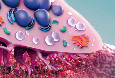 Osteoporosis secundaria 