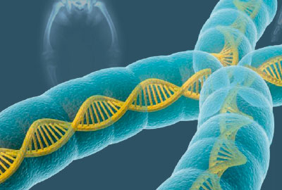 Raquitismo hipofofatémico ligado al X