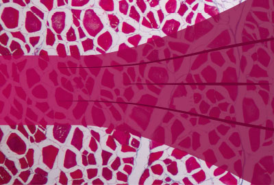 Sarcopenia salud muscular