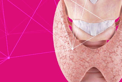 Nódulos y cáncer de tiroides